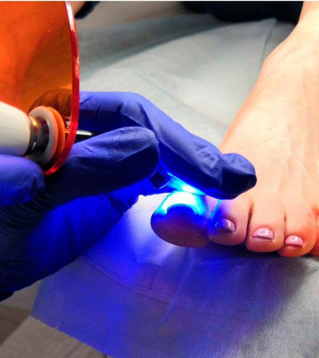 Pedicure Clínico en Puerto Montt - Marcela Valdés Población 22 de Mayo